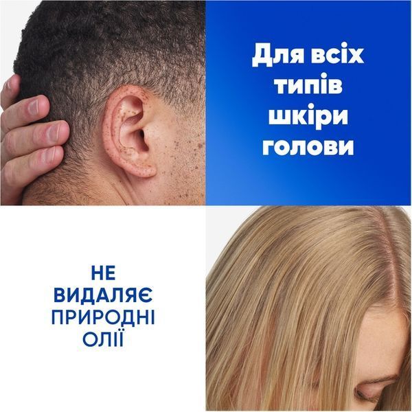 Шампунь проти лупи Head & Shoulders Ultra Total Care 330 мл для щоденного використання 00000000937 фото