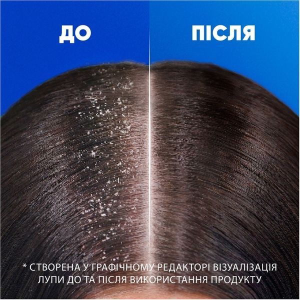 Шампунь проти лупи Head & Shoulders Ultra Total Care 330 мл для щоденного використання 00000000937 фото